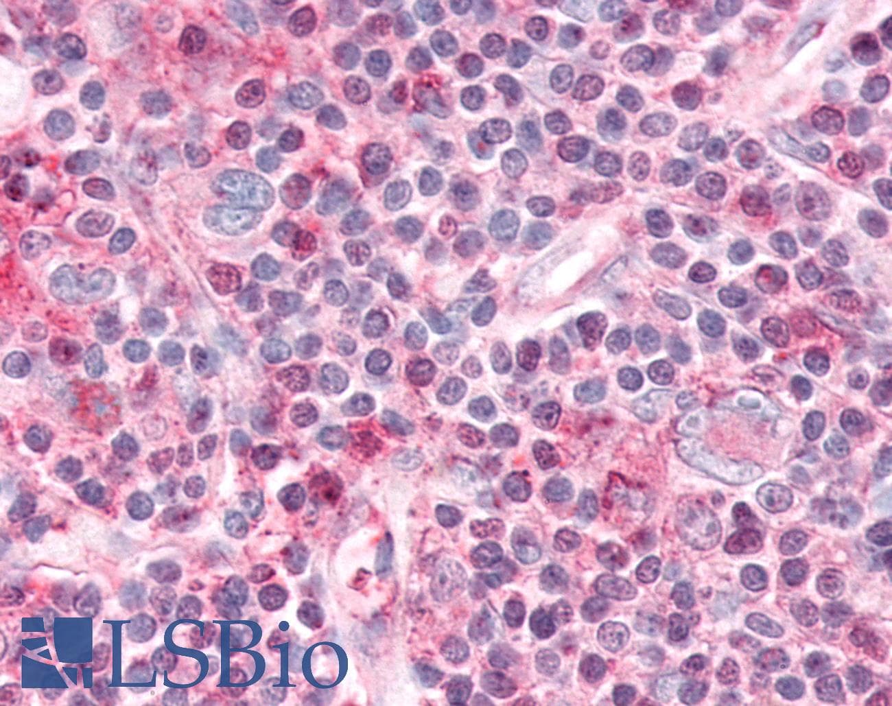 PathPlus™ Polyclonal Rabbit anti-Human NR1D1 Antibody (Internal, IHC)
