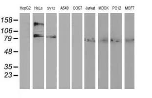 ADH2 / ADH1B Antibody (clone OTI4F12)