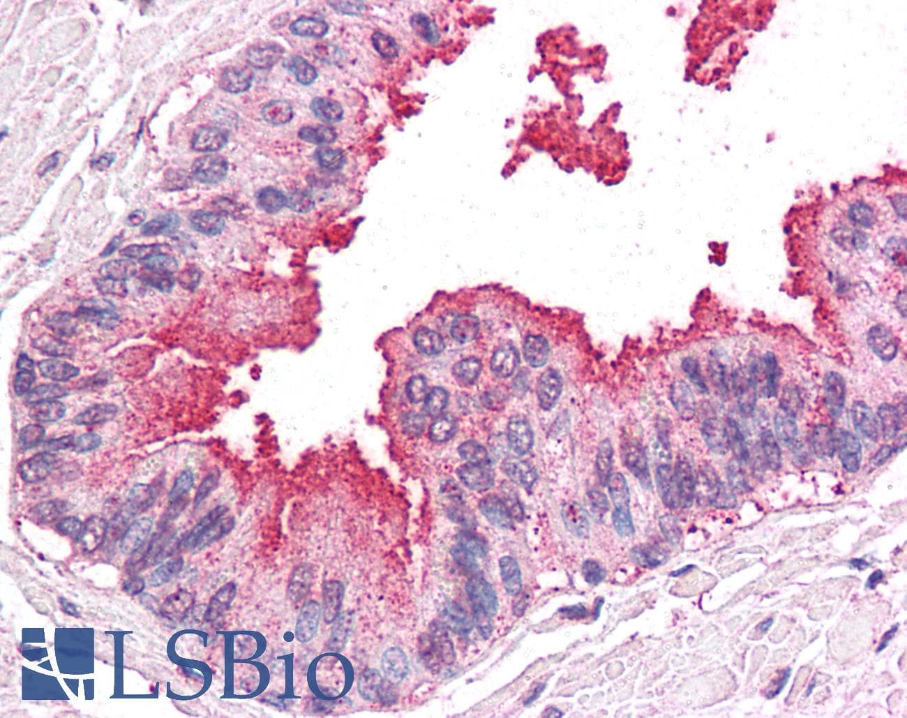 IHC-plus™ Polyclonal Rabbit anti-Human ARTS1 / ERAP1 Antibody (Internal, IHC)