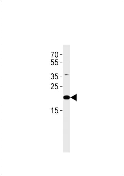 C2orf74 Antibody (aa164-194)