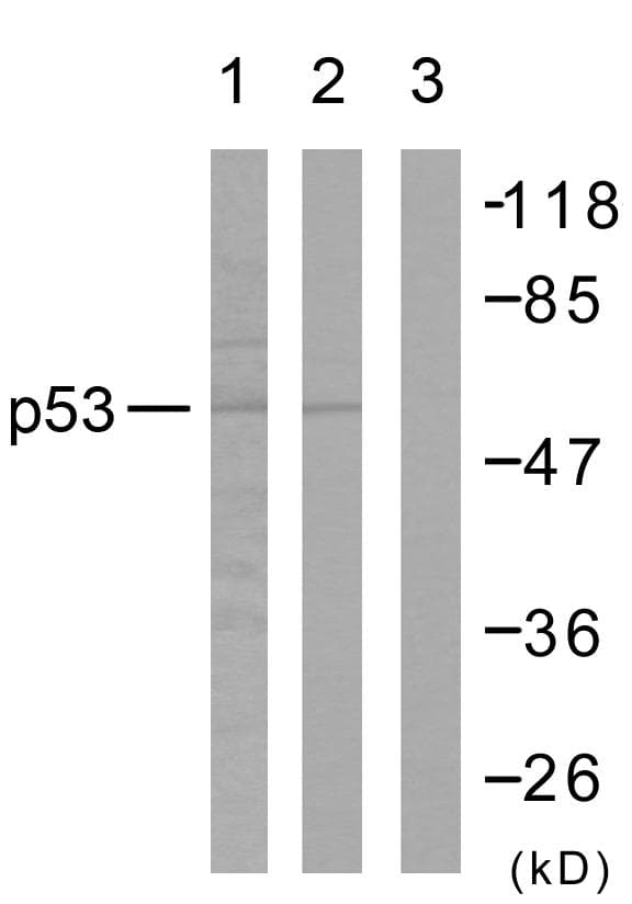 TP53 / p53 Antibody (p15)