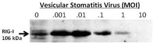 DDX58 / RIG-1 / RIG-I Antibody (aa894-925)