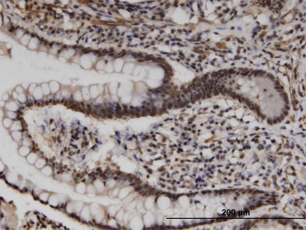 UPF3A / UPF3 Antibody (clone 2E2)