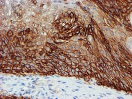 Monoclonal Mouse anti-Human FXYD3 Antibody (clone OTI1E8, IHC, IF, WB)