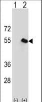 CPN1 Antibody (aa210-240)