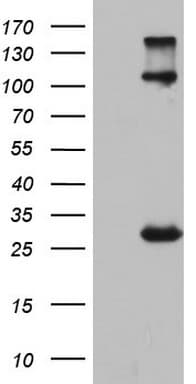 Monoclonal Mouse anti-Human IGSF11 / VSIG3 Antibody (clone OTI3A4, aa23-241, WB)