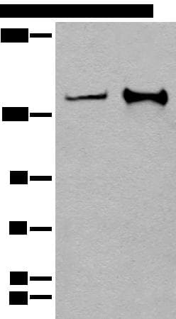 CAPN15 / SOLH Antibody