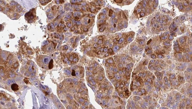 SCN3A / Nav1.3 Antibody