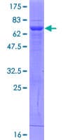 Human FBP2 Protein (Recombinant GST)