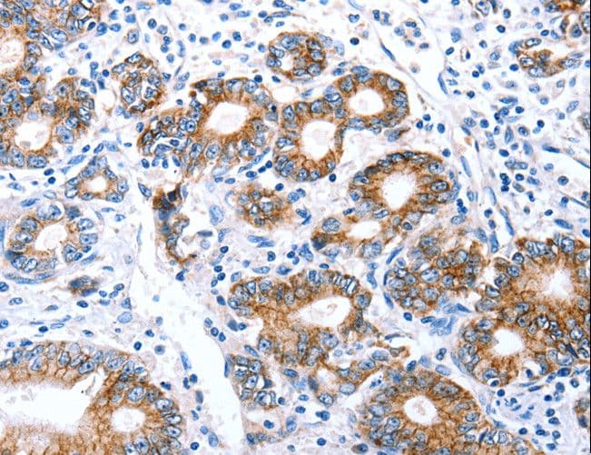 CLDN7 / Claudin 7 Antibody