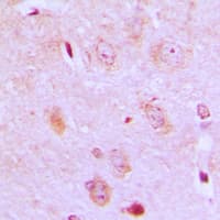 IARS2 Antibody (N-Terminus)