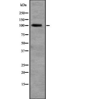 Polyclonal Rabbit anti-Human RALGDS Antibody (WB)