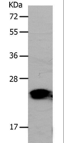 Polyclonal Rabbit anti-Human PNOC / Nociceptin Antibody (WB)