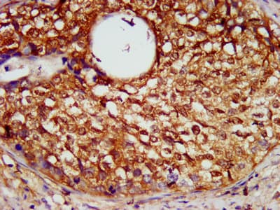 SERPINB4 / SCCA1+2 Antibody