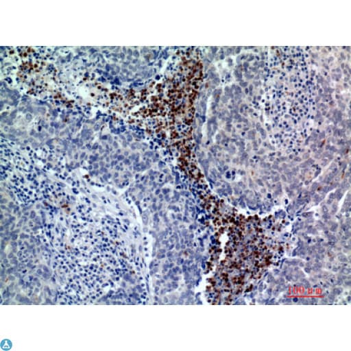 Polyclonal Rabbit anti-Human BATF3 Antibody (IHC, WB)