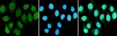 RPA70 / RPA1 Antibody