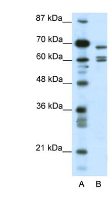 Polyclonal Rabbit anti-Human KCNK5 / TASK2 Antibody (aa421-470, IHC, IF, WB)