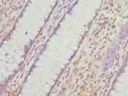 VWA9 / C15orf44 Antibody