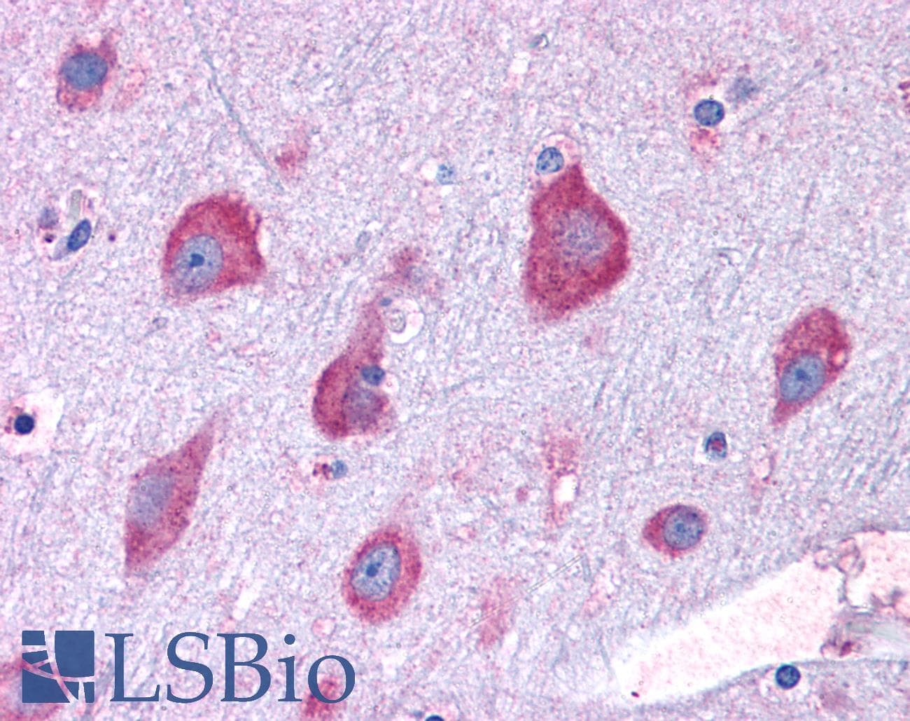 IHC-plus™ RPL22 / Ribosomal Protein L22 Antibody (aa106-119)