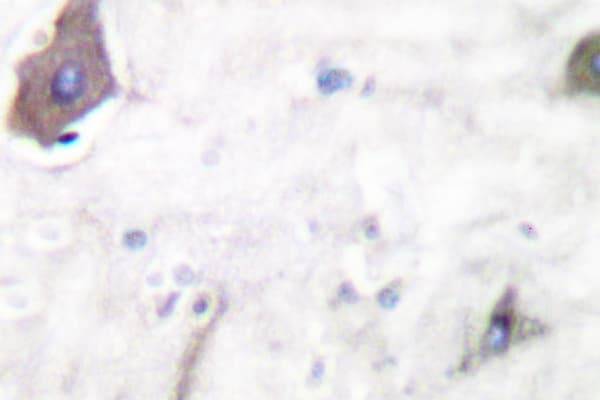 Polyclonal Rabbit anti-Human PTGS1 / COX-1 Antibody (Ser585, IHC, WB)