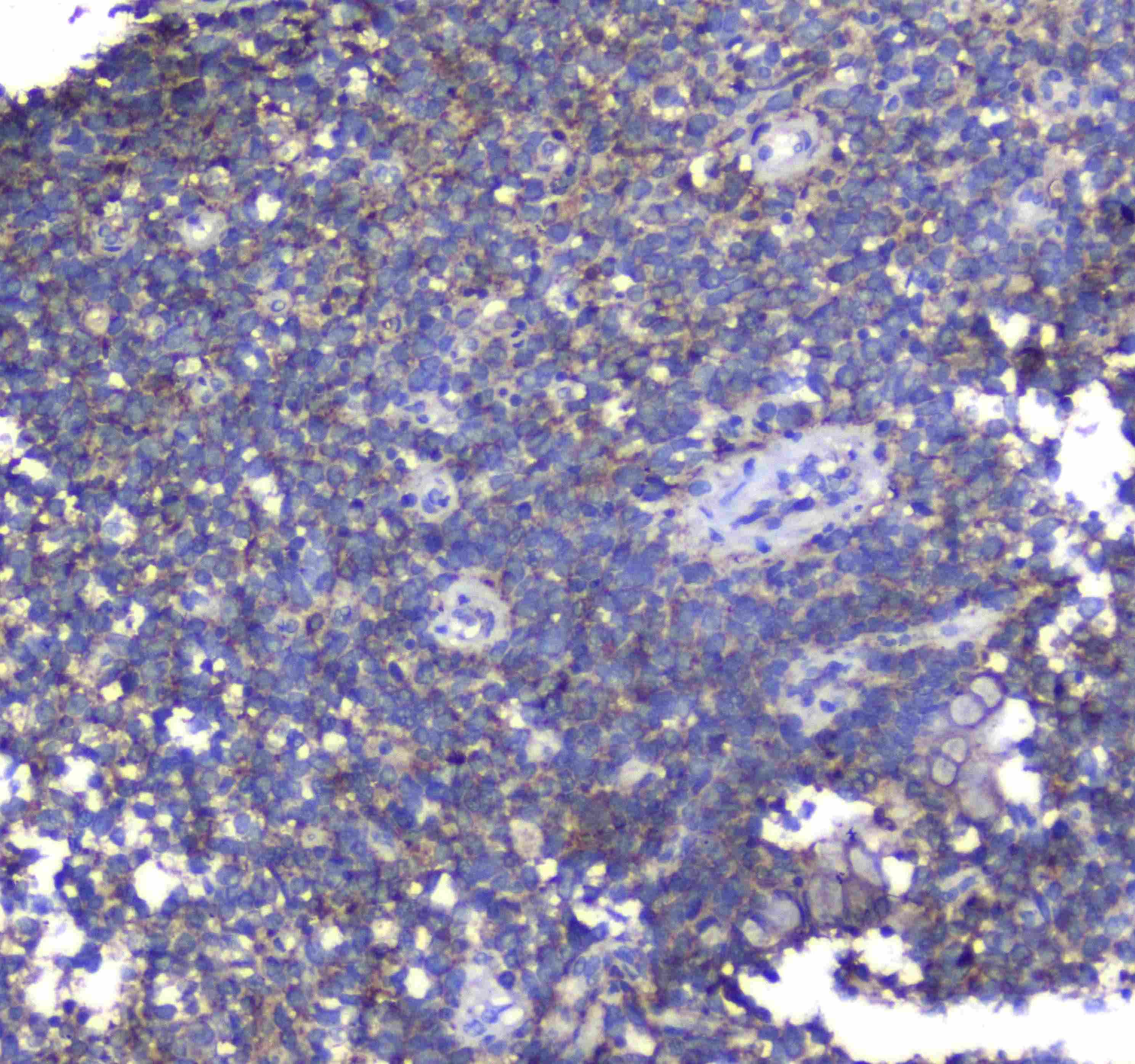 SYT1 / Synaptotagmin Antibody