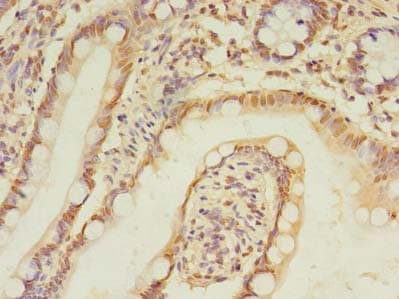 Polyclonal Rabbit anti-Human TRIM15 Antibody (IHC, WB)