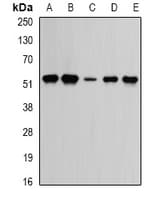 WARS Antibody