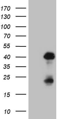 OTX2 Antibody (clone OTI1A1)