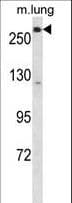 LRP5 Antibody (aa1163-1190)