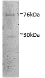 IHC-plus™ DVL1 / DVL / Dishevelled Antibody (aa20-32)