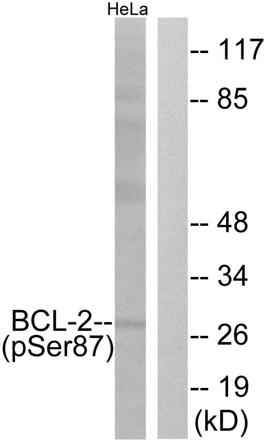 BCL2 / Bcl-2 Antibody (phospho-Ser87)