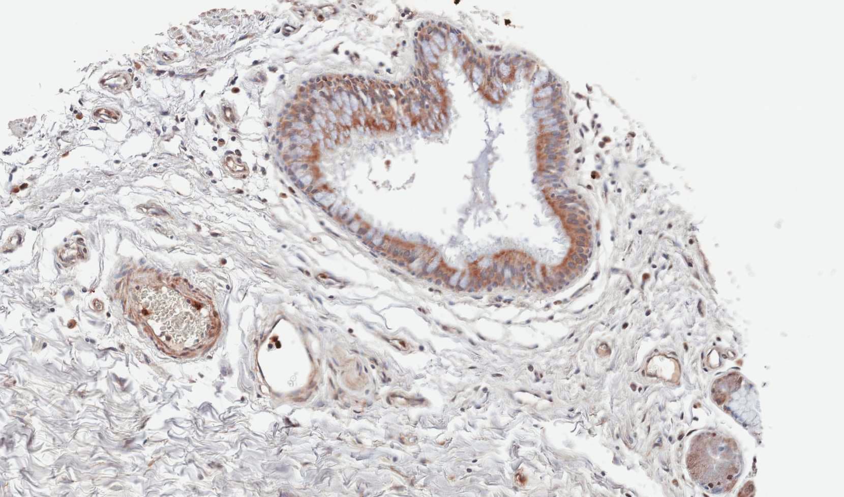 WNT11 Antibody (aa1-310)
