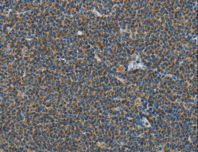 PITX3 Antibody