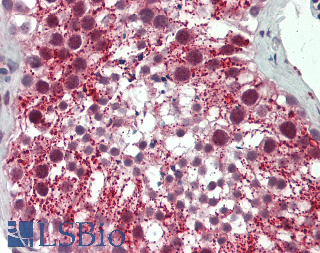 ODF3 Antibody (aa96-145)