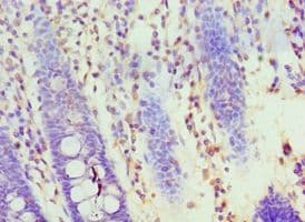 Polyclonal Rabbit anti-Human HOXA1 Antibody (aa75-205, IHC, WB)