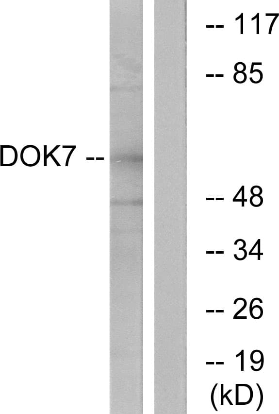 Polyclonal Rabbit anti-Human DOK7 Antibody (aa10-59, IHC, IF, WB)