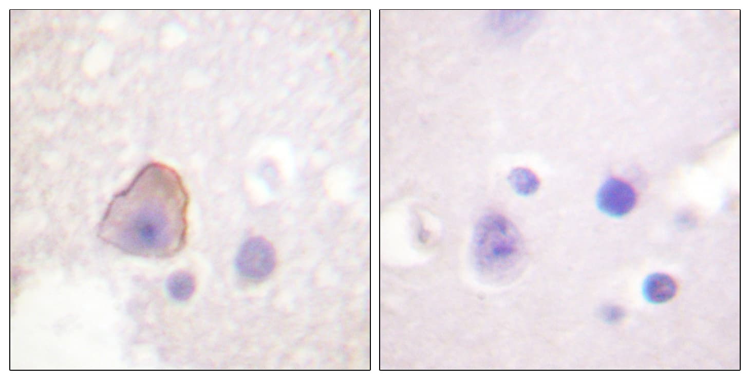 ADD1 / Adducin Alpha Antibody (C-Terminus)