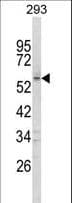 FOXC1 Antibody (aa488-515)