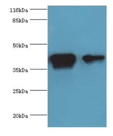 CKB / Creatine Kinase BB Antibody (aa2-270)
