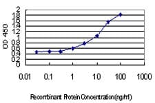 IHC-plus™ IRF4 Antibody (clone 2F2)