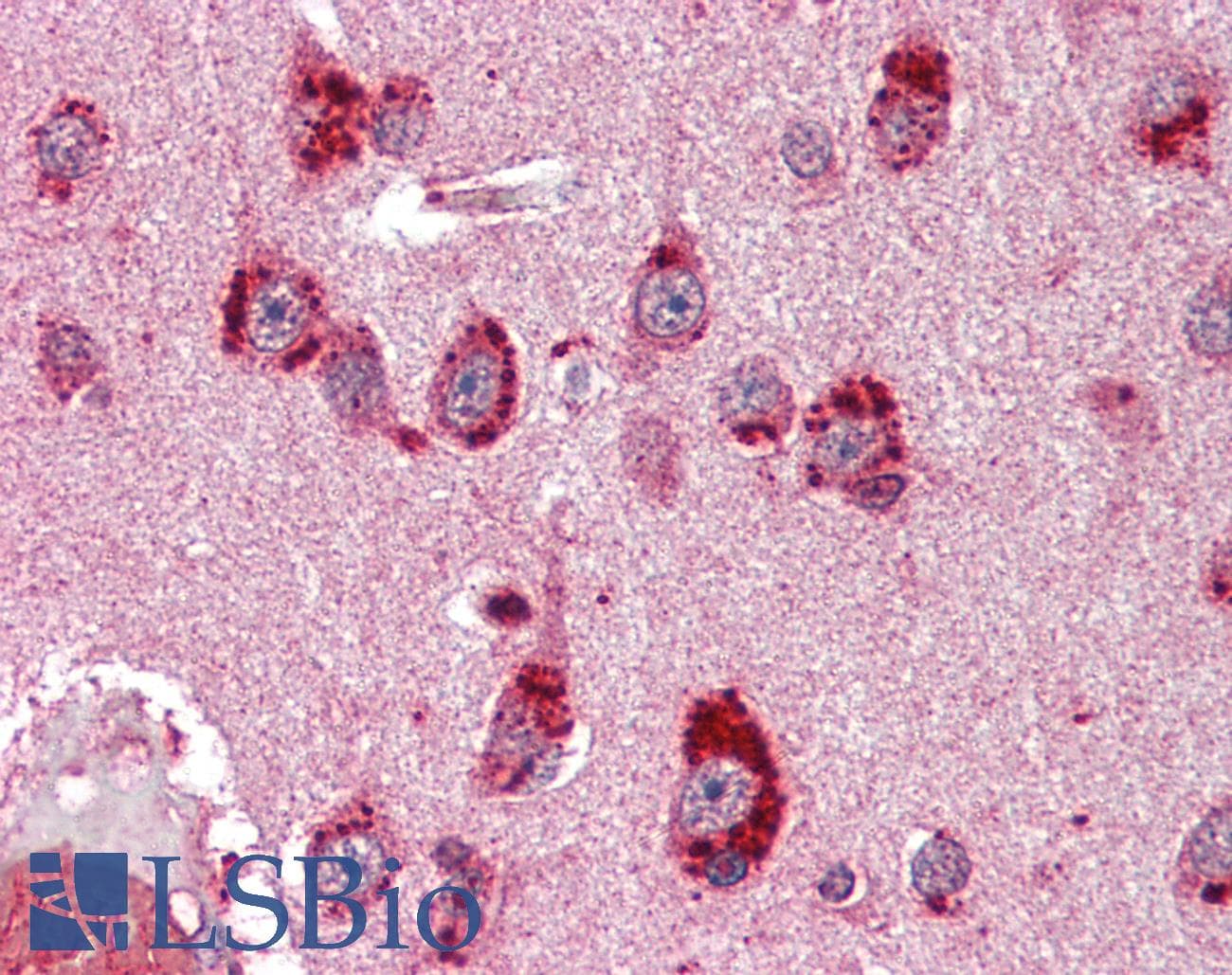 IHC-plus™ Mineralocorticoid Receptor Antibody (clone H10E4C9F)