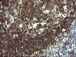 CD19 Antibody (clone OTI1F9)
