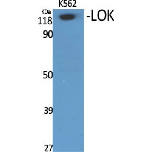 Polyclonal Rabbit anti-Human STK10 / LOK Antibody (460-540 aa, Internal, WB)