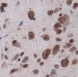 PECAM-1 / CD31 Antibody (DY488)