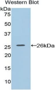 F8A1 / HAP40 Antibody (aa171-375, FITC)