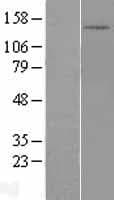 DHX30 Protein (Over-Expression Lysate Myc-DDK (Flag))