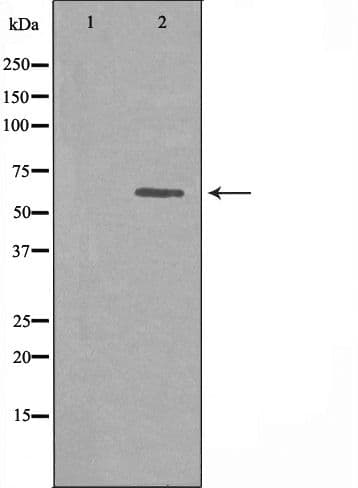 SP32 / ACRBP Antibody
