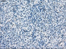 BCKDK Antibody (clone OTI11C9)