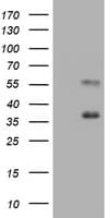 EMA / MUC1 Antibody (clone OTI3A7)