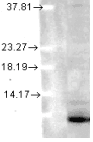 UBC / Ubiquitin C Antibody